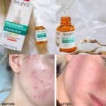 Balance Niacinamide Blemish Recovery Serum 30ml - Image 3